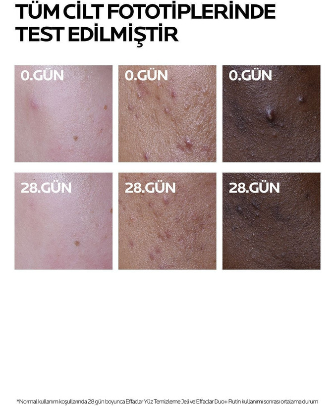 کرم صورت برند La roche posay مدل Effaclar Duo+M